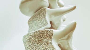 osteoporosis hueso
