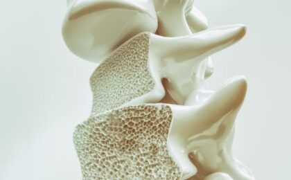 osteoporosis hueso