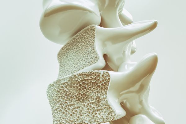 Alimentos ricos en calcio para fortalecer los huesos y prevenir la osteoporosis