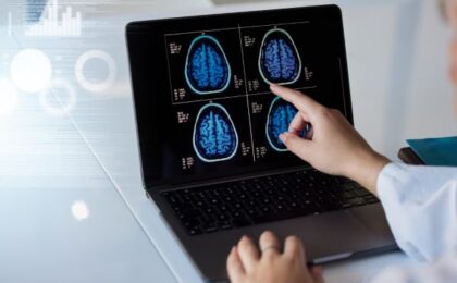 enfermedades neurodegenerativas