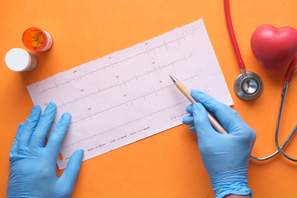 ¿Qué es el cateterismo cardíaco?