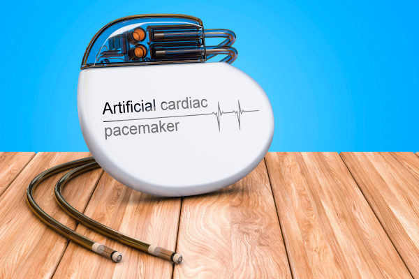 ¿Quién necesita un marcapasos y cómo es vivir con uno?